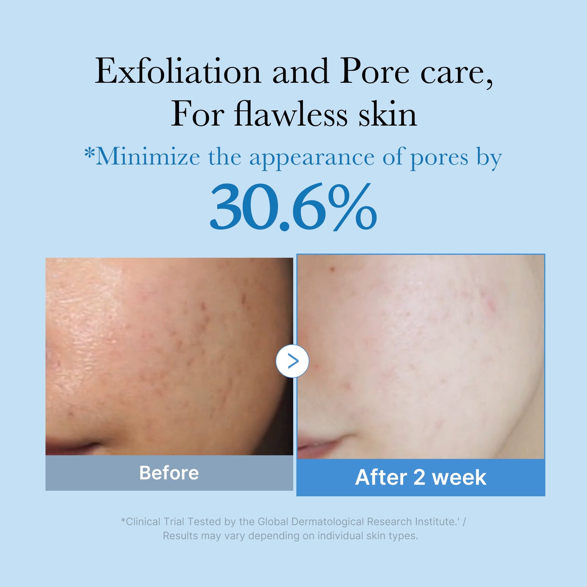 zero-pore-toner-s0 01_d6480b4e-3c08-4954-994a-ed5212c1839c.jpg