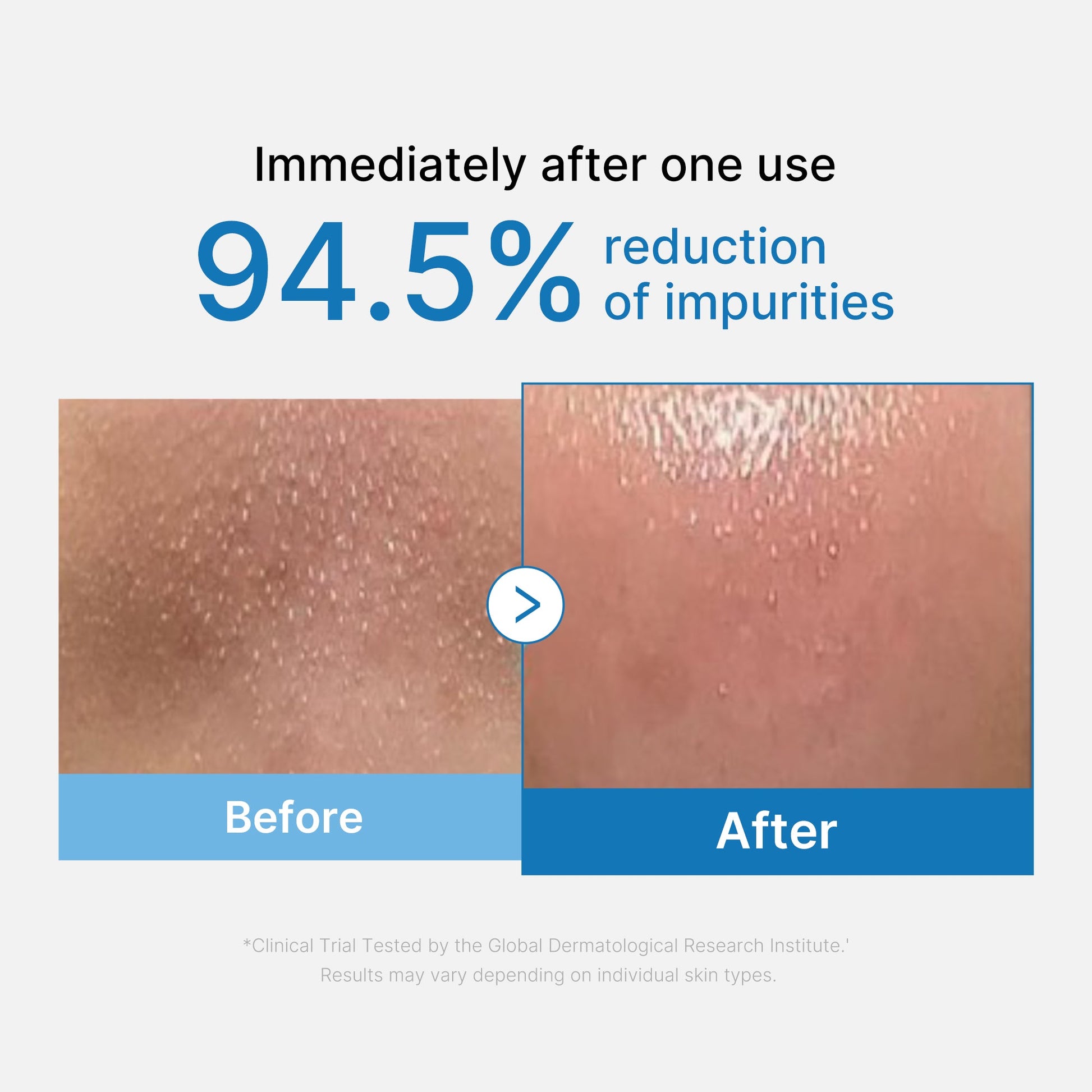 zero-pore-blackhead-deep-cleansing-oil-e2 01_eed557ec-5857-46a2-8b17-dbd67c692dcb.jpg