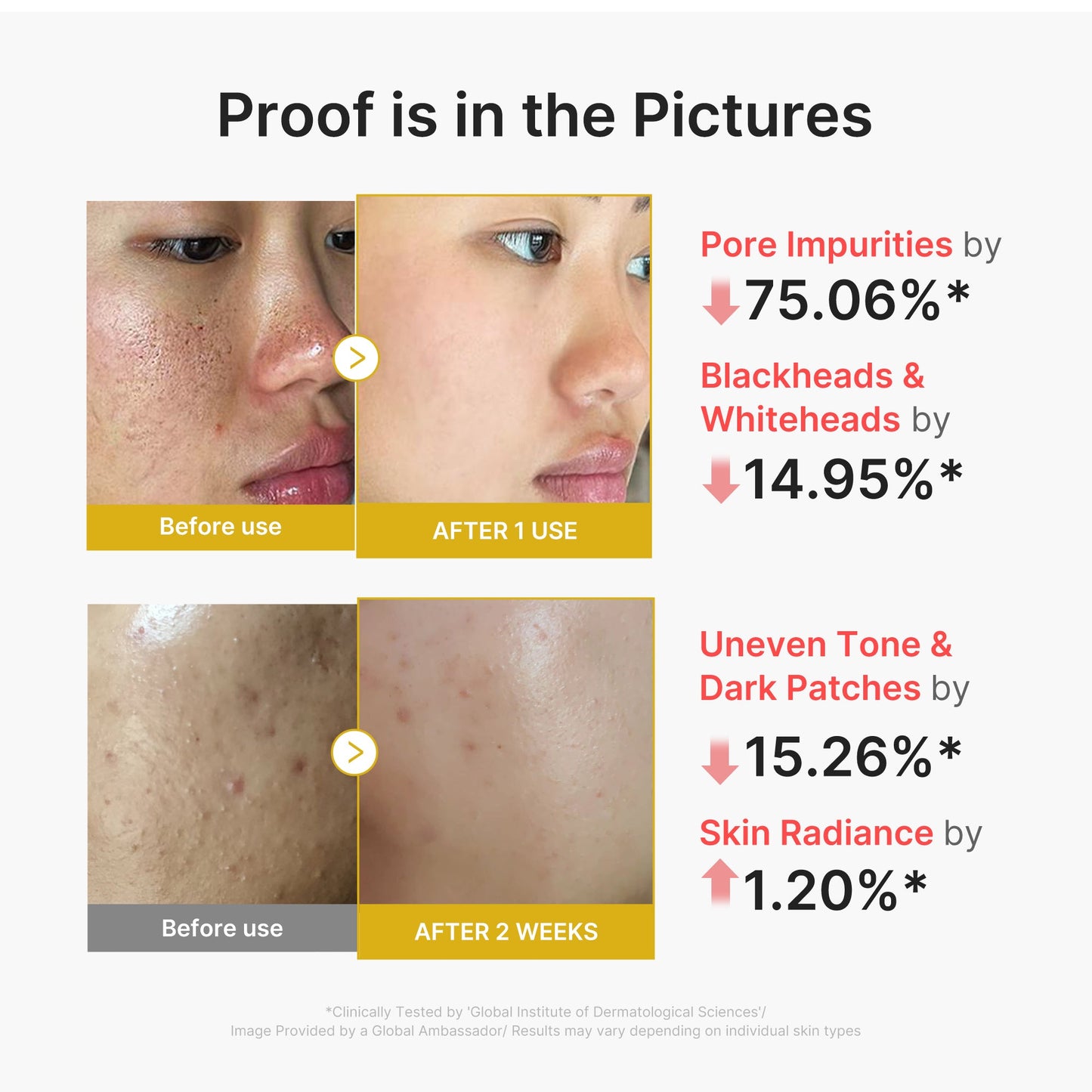 kojic-acid-turmeric-peel-shot-f0 02_45fe66d3-b3f6-4100-aa52-2afd7eded417.jpg