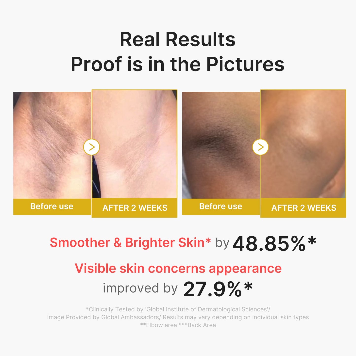 kojic-acid-turmeric-body-peel-shot-e4 02_72880cfc-382b-440b-8152-7e3dce87da2a.jpg