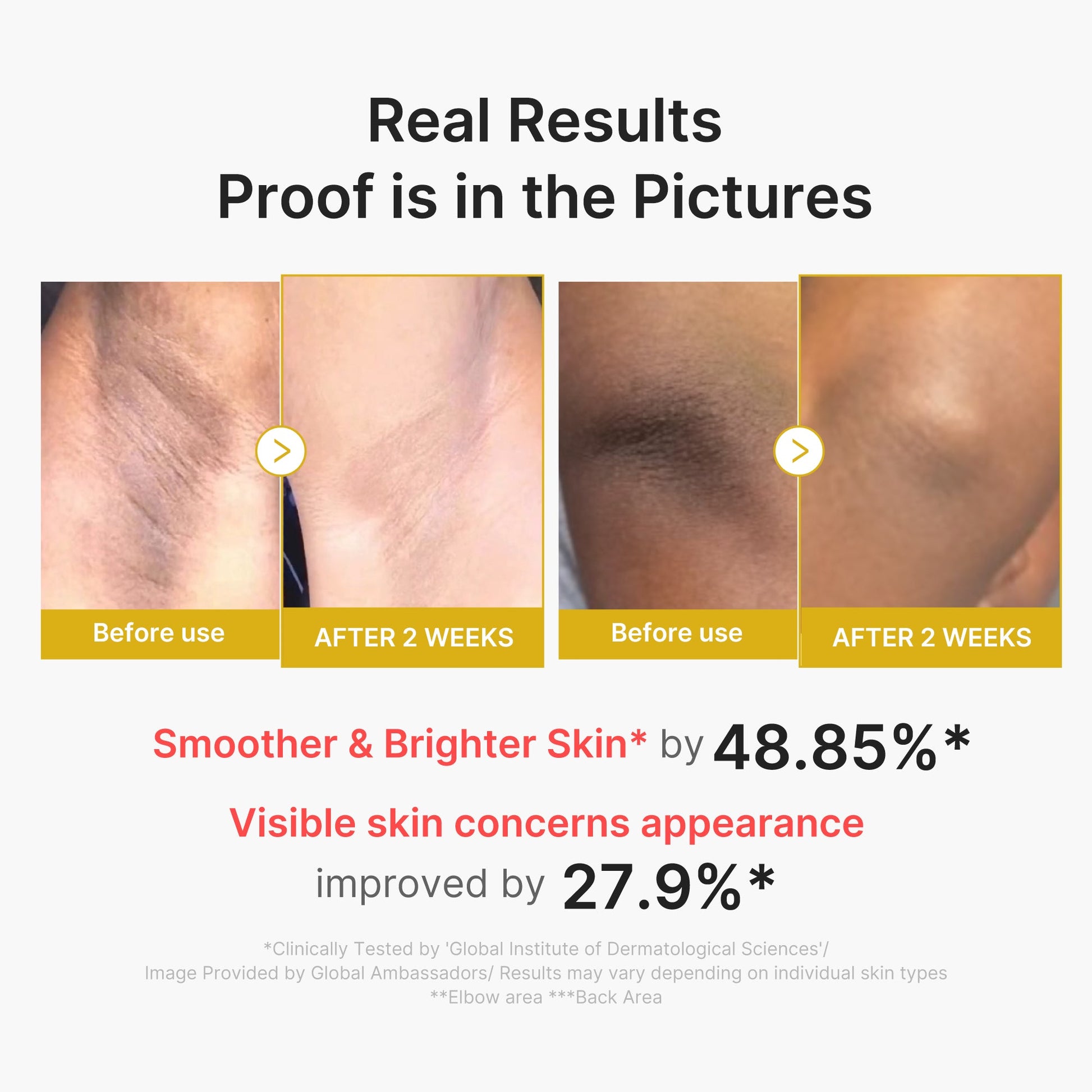 kojic-acid-turmeric-body-peel-shot-e4 02_72880cfc-382b-440b-8152-7e3dce87da2a.jpg