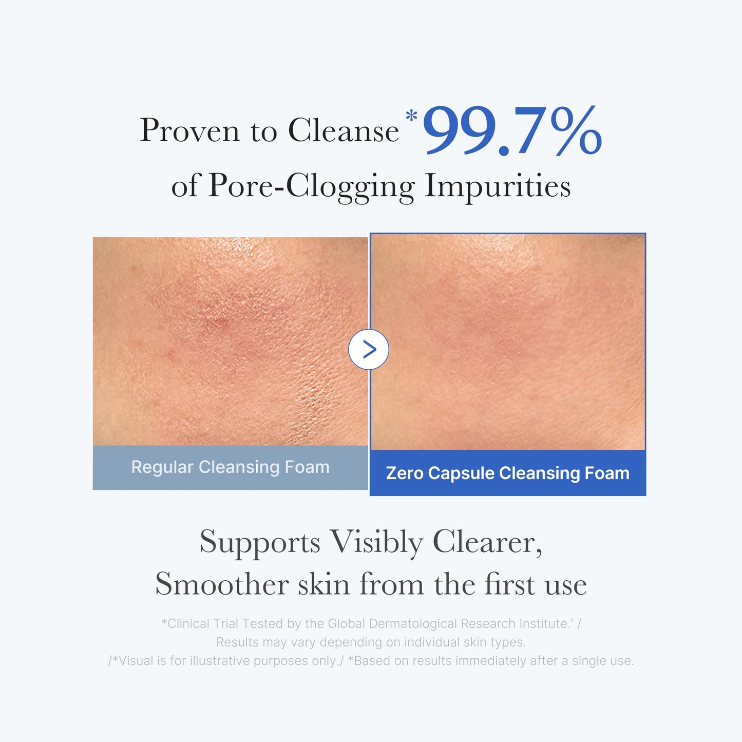 zero-pore-capsule-cleansing-foam-t6 02_c1fb9dfb-86c5-4038-8ff8-490d1006276c.jpg