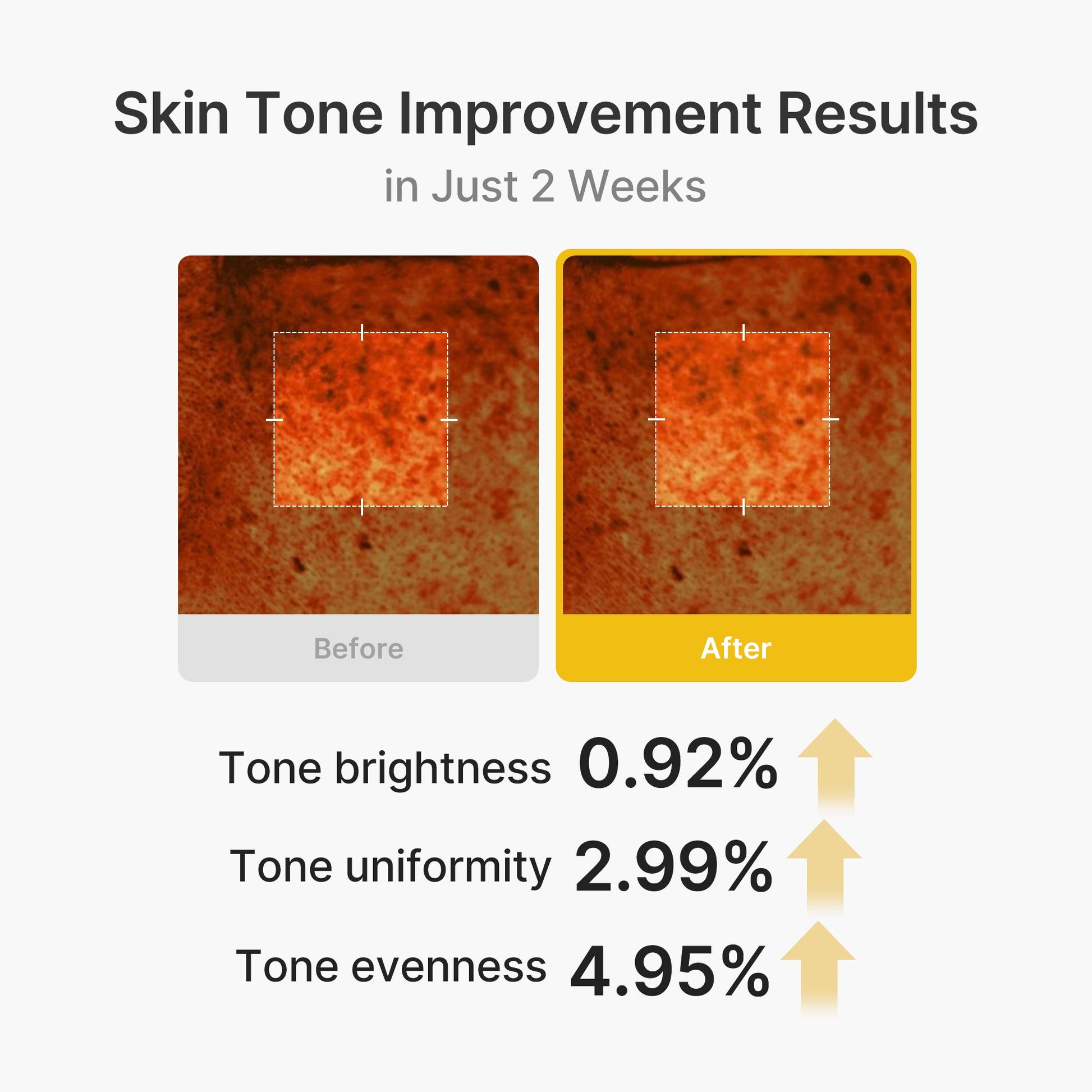 kojic-acid-turmeric-vita-capsule-cream-v0 03_2b626701-fc6c-4702-9e96-a2157a4f7f9d.jpg