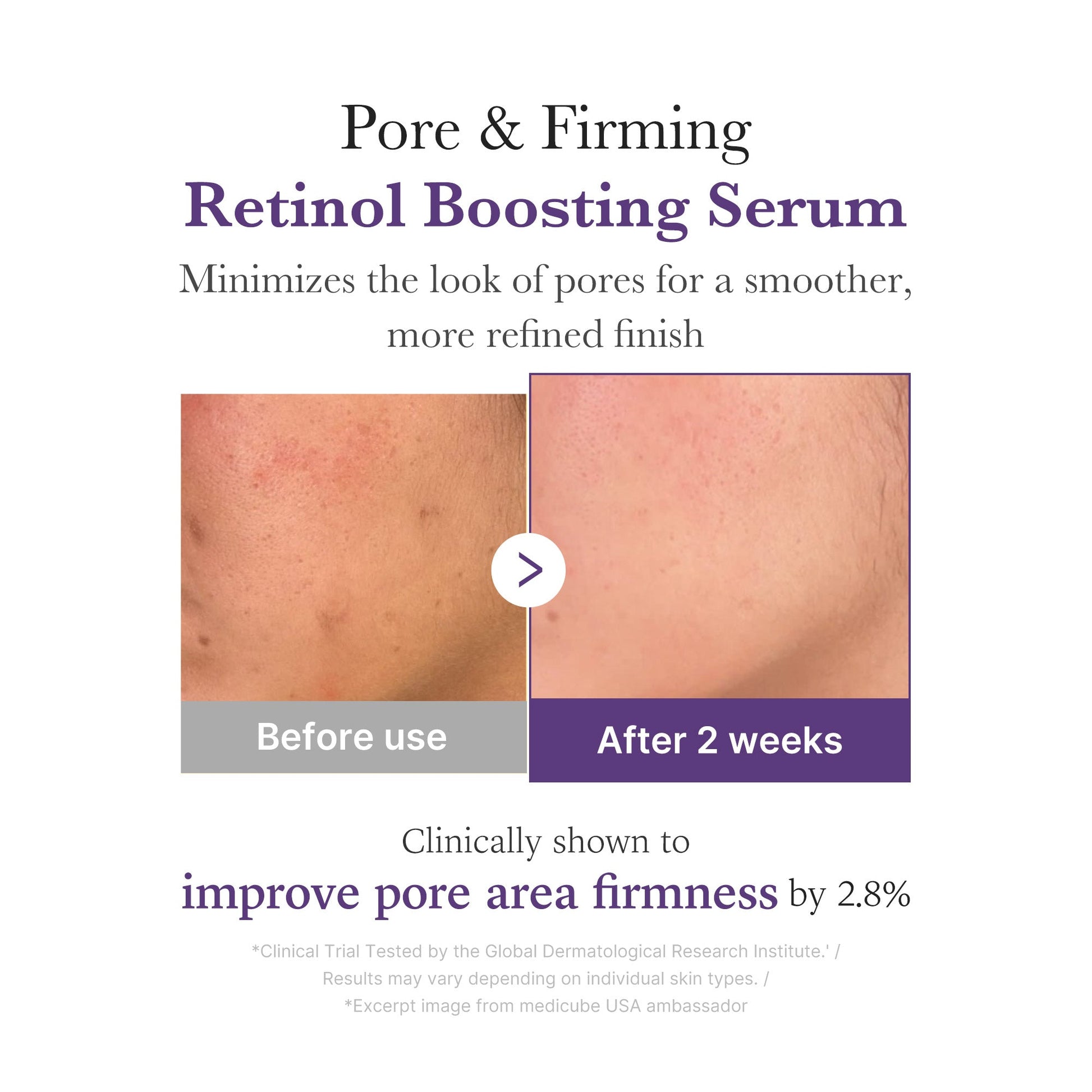 retinol-nmn-boosting-serum-o7 03_3510e7a5-5633-4a18-81ea-1389593bd517.jpg