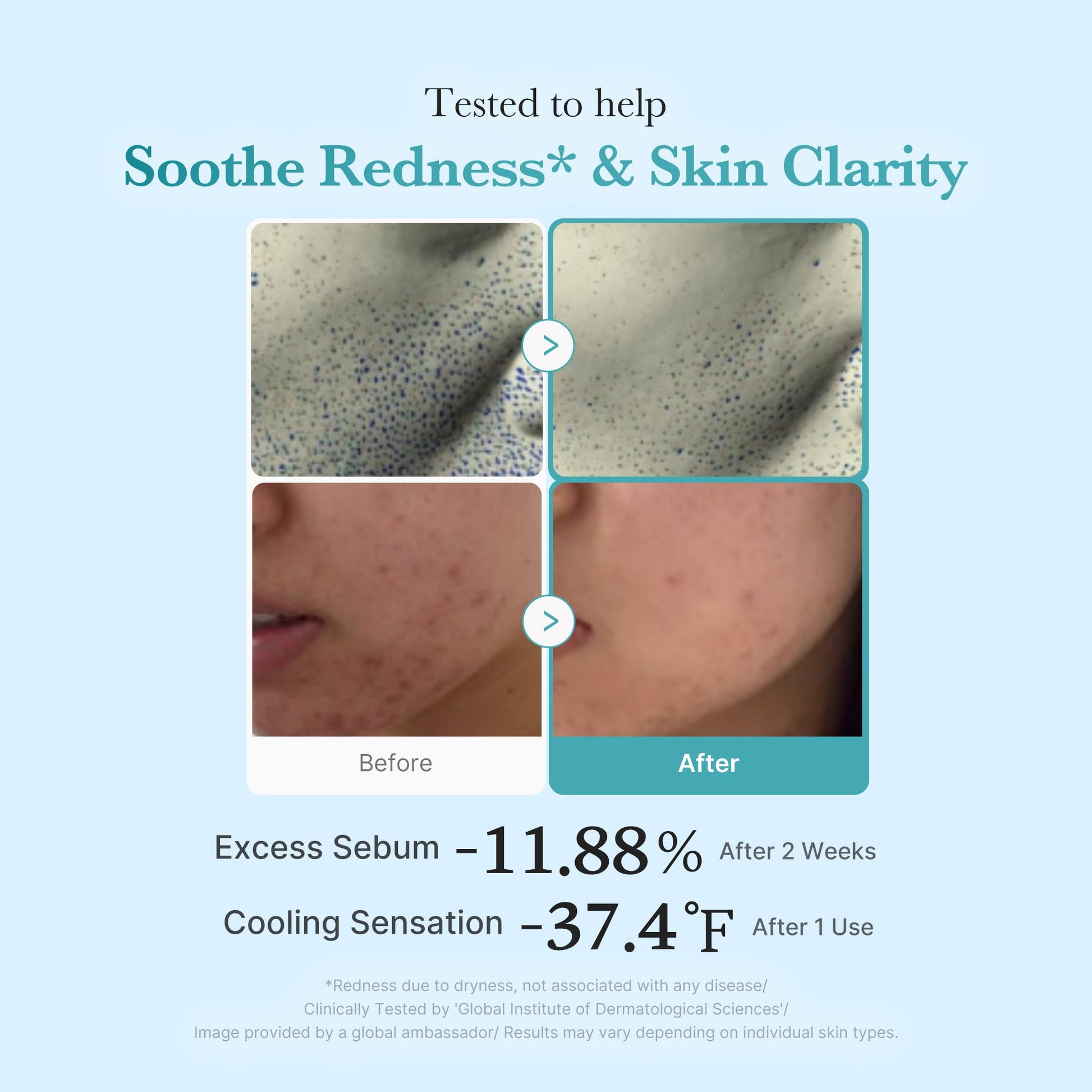 azelaic-acid-niacinamide-clarifying-toner-r6 03_9339e653-97a3-4b81-8763-9632be2263bf.jpg