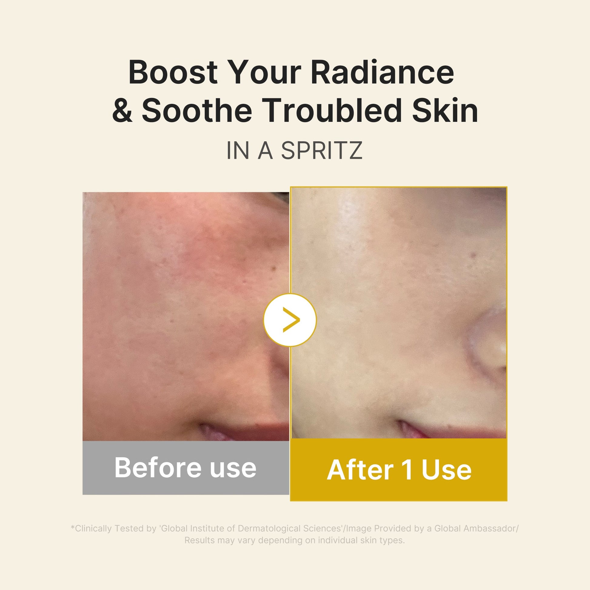 kojic-acid-turmeric-vitamin-gold-jelly-mist-serum-q5 03_dc9cd19e-4e57-49d3-9b66-c7762e8a63f1.jpg