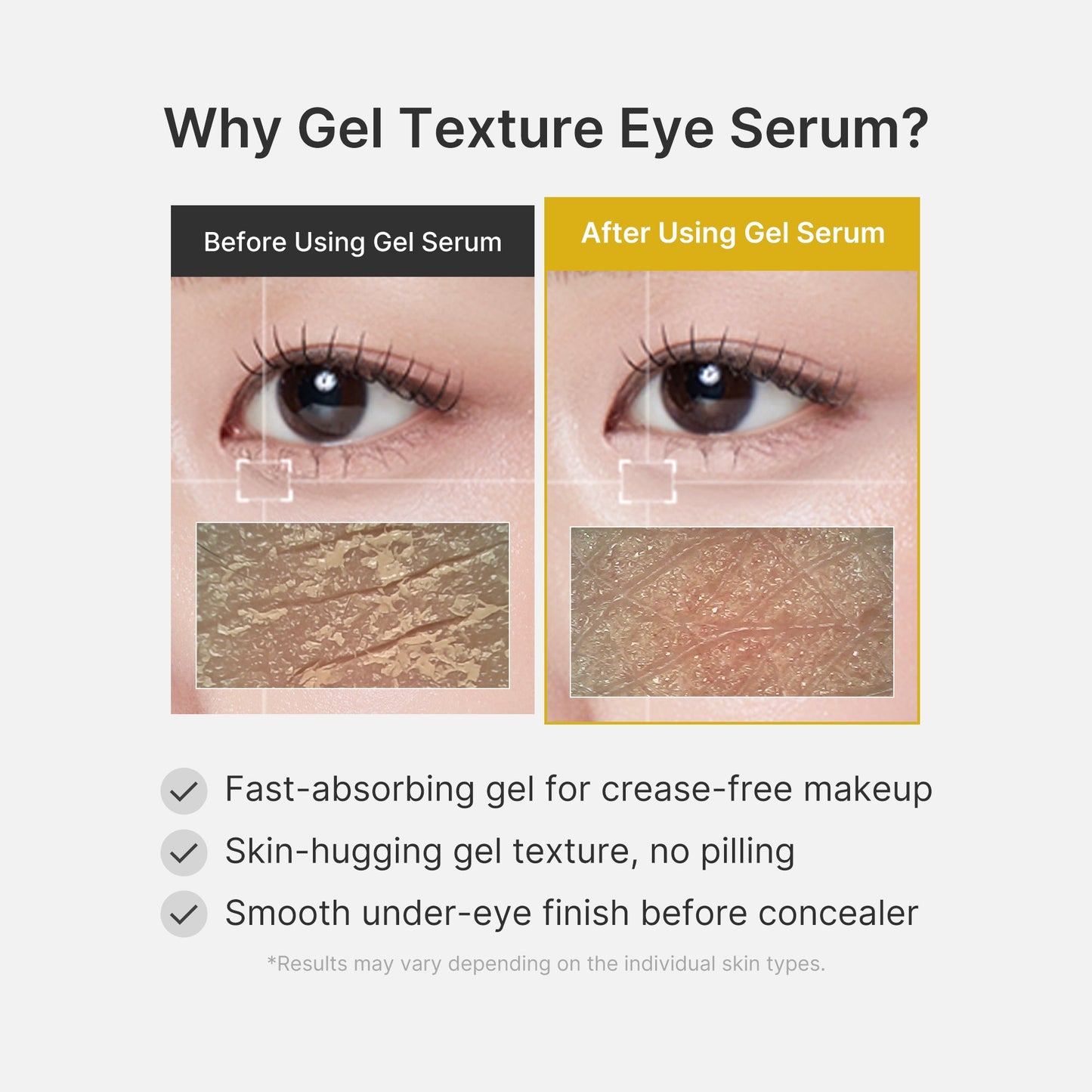 kojic-acid-tumeric-eye-gel-serum-o2 04_0487ef36-49f4-4294-8049-bb55118b05fe.jpg