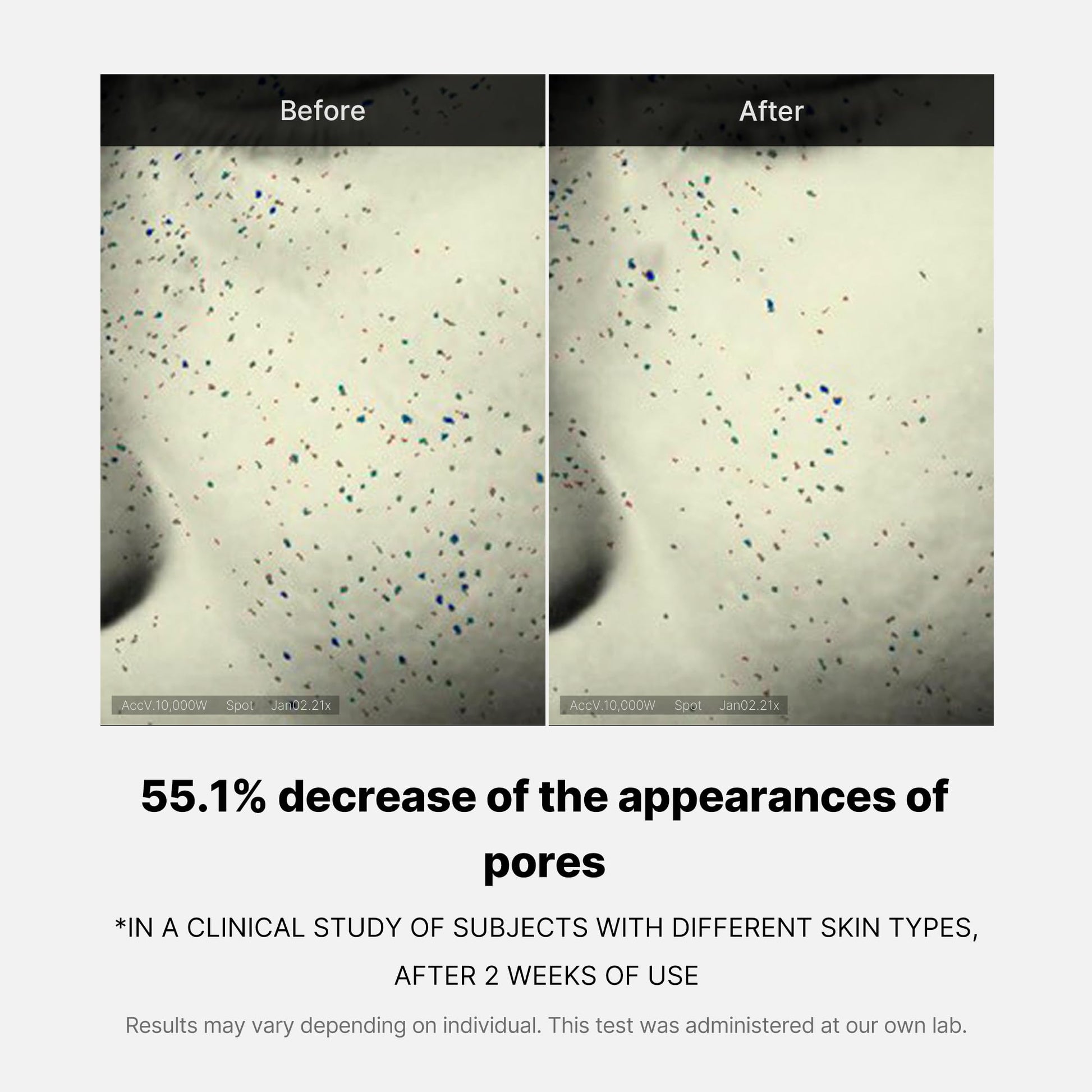 zero-pore-one-day-cream-w3 04_3616addc-f184-4deb-a5d7-e3a782e4713d.jpg