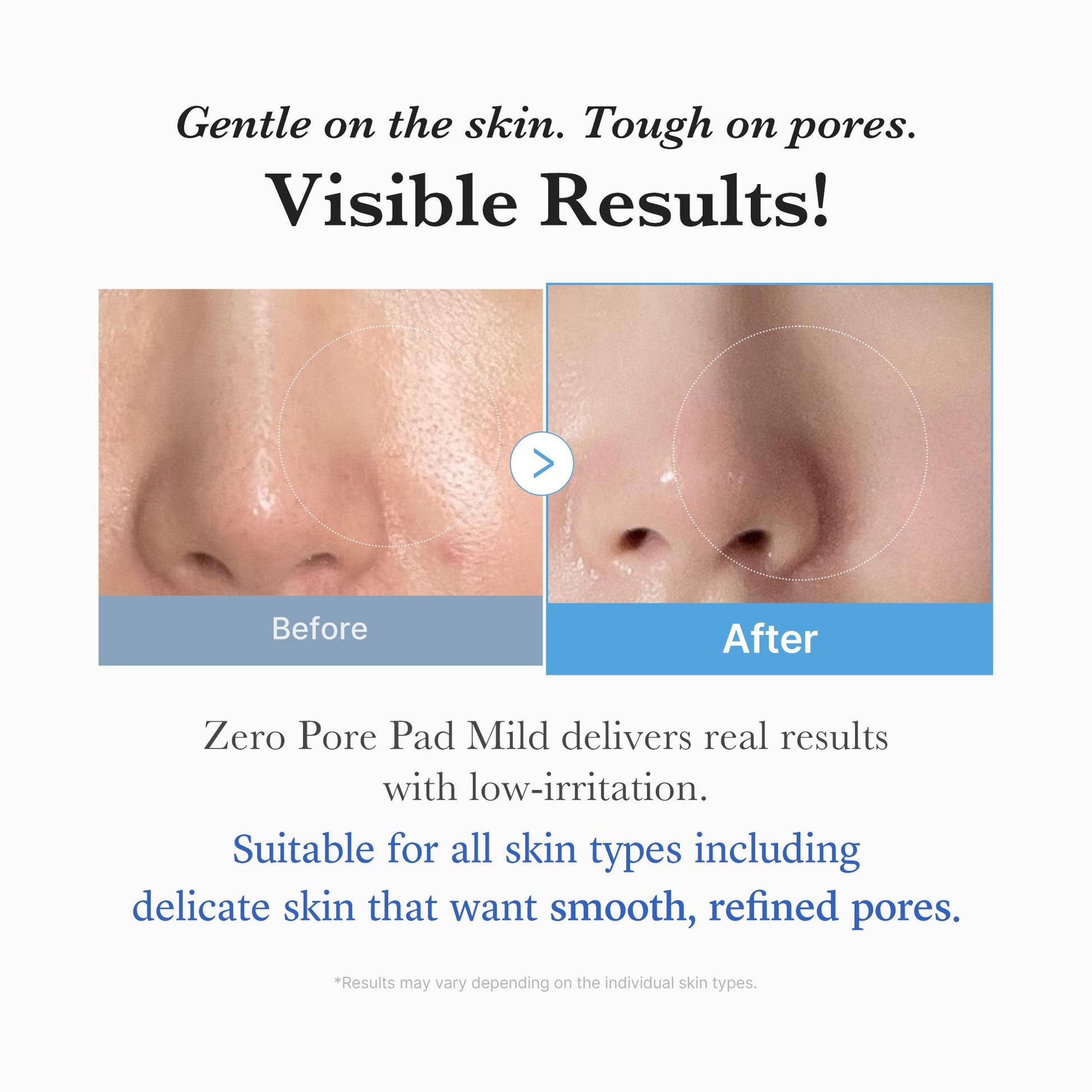 zero-pore-madecassoside-pads-mild-e1 04_6357f9f9-483b-4891-82c6-a58d336e62c8.jpg
