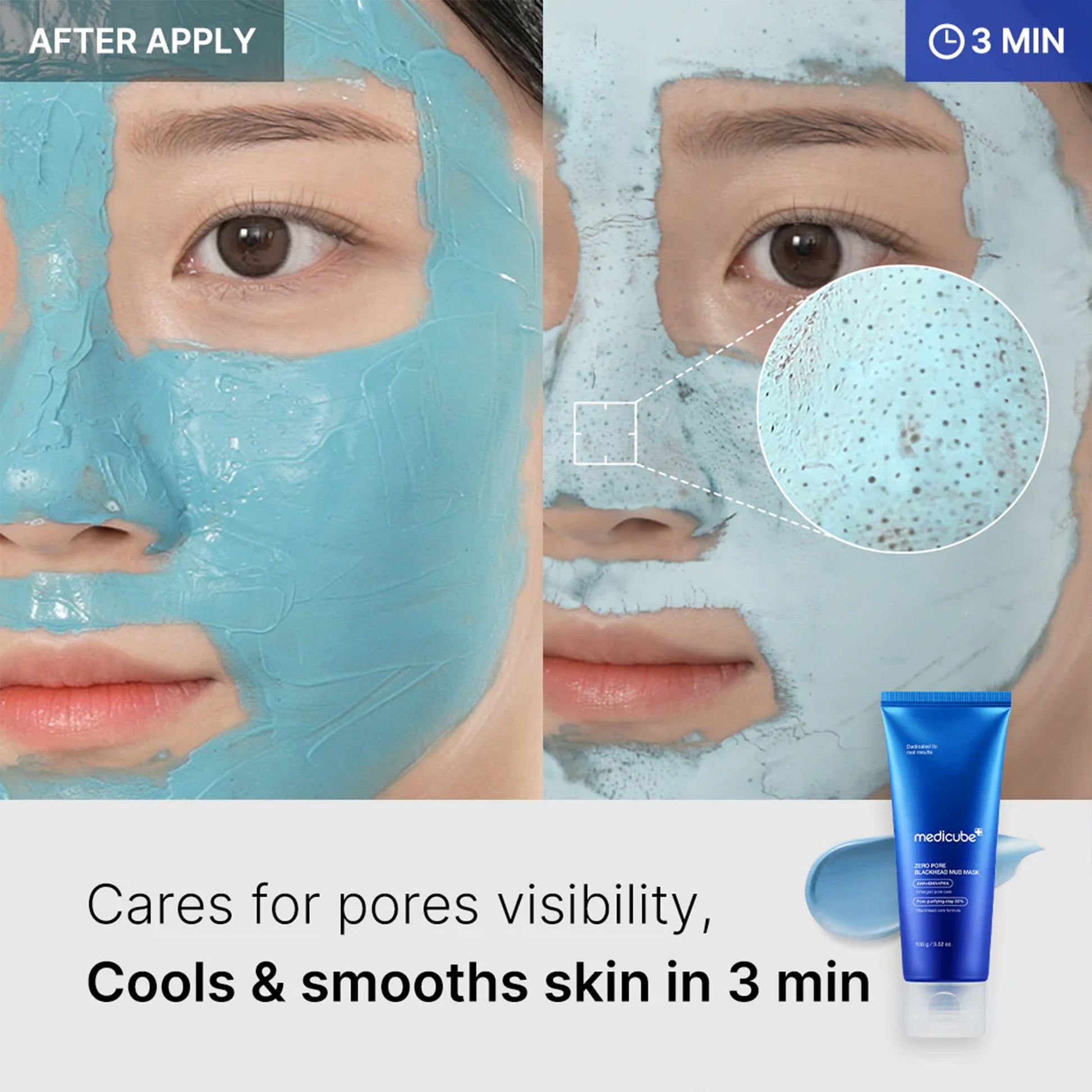 zero-pore-blackhead-mud-mask-e5 04_867c0459-a94e-40d3-bd9a-70400edabe8d.jpg