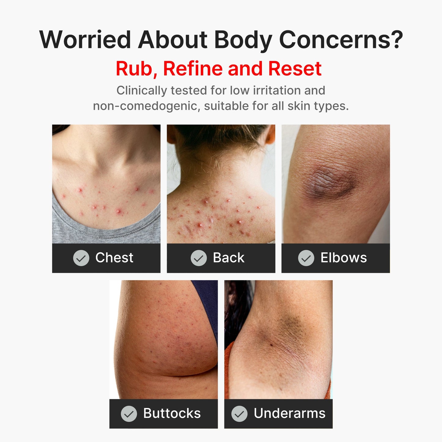 kojic-acid-turmeric-body-peel-shot-e4 04_8a7237f2-3ebf-401e-bd85-54841aeb3efc.jpg