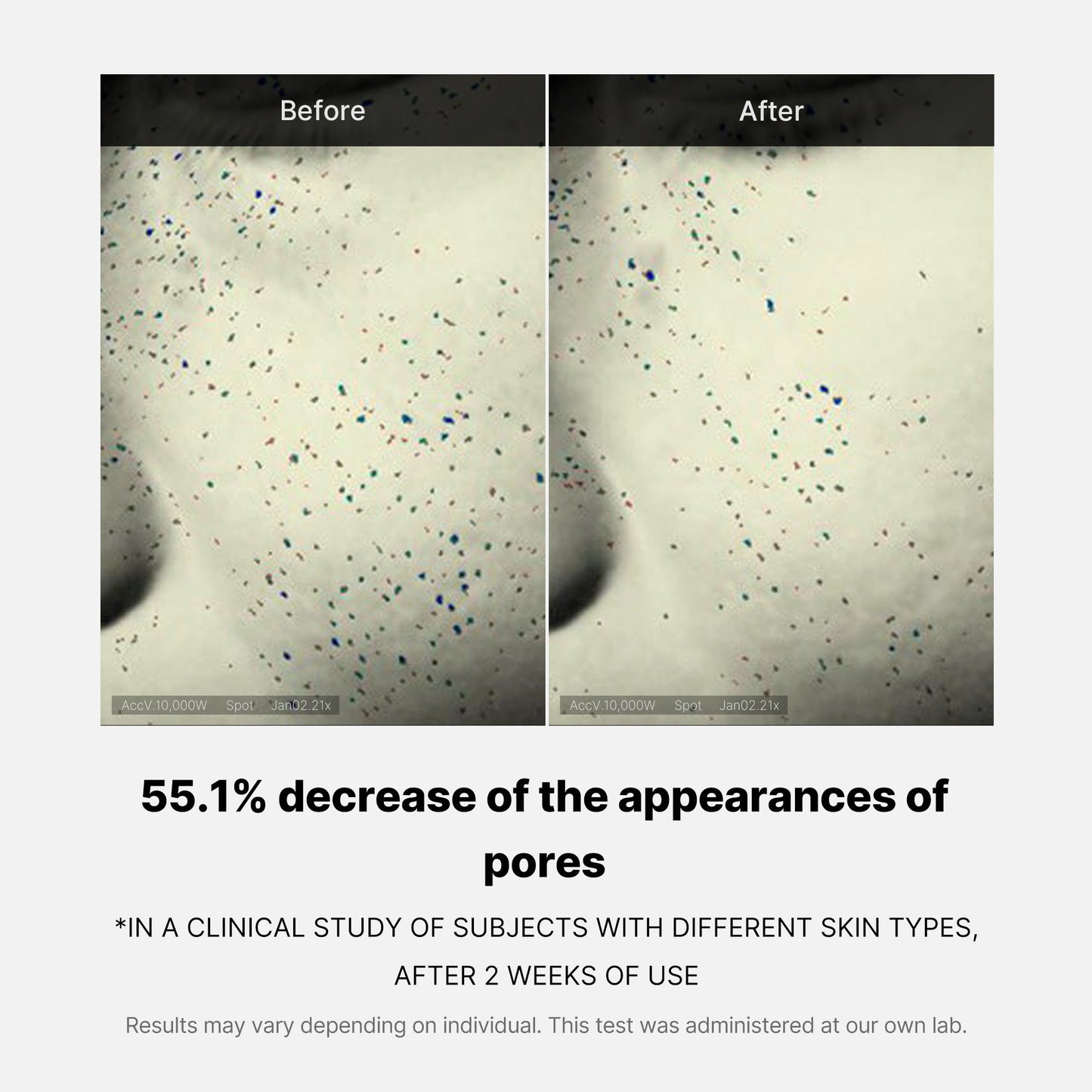 pore-care-duo-y4 05_12ddab8a-64be-4612-8ee1-27e5ec701921.jpg