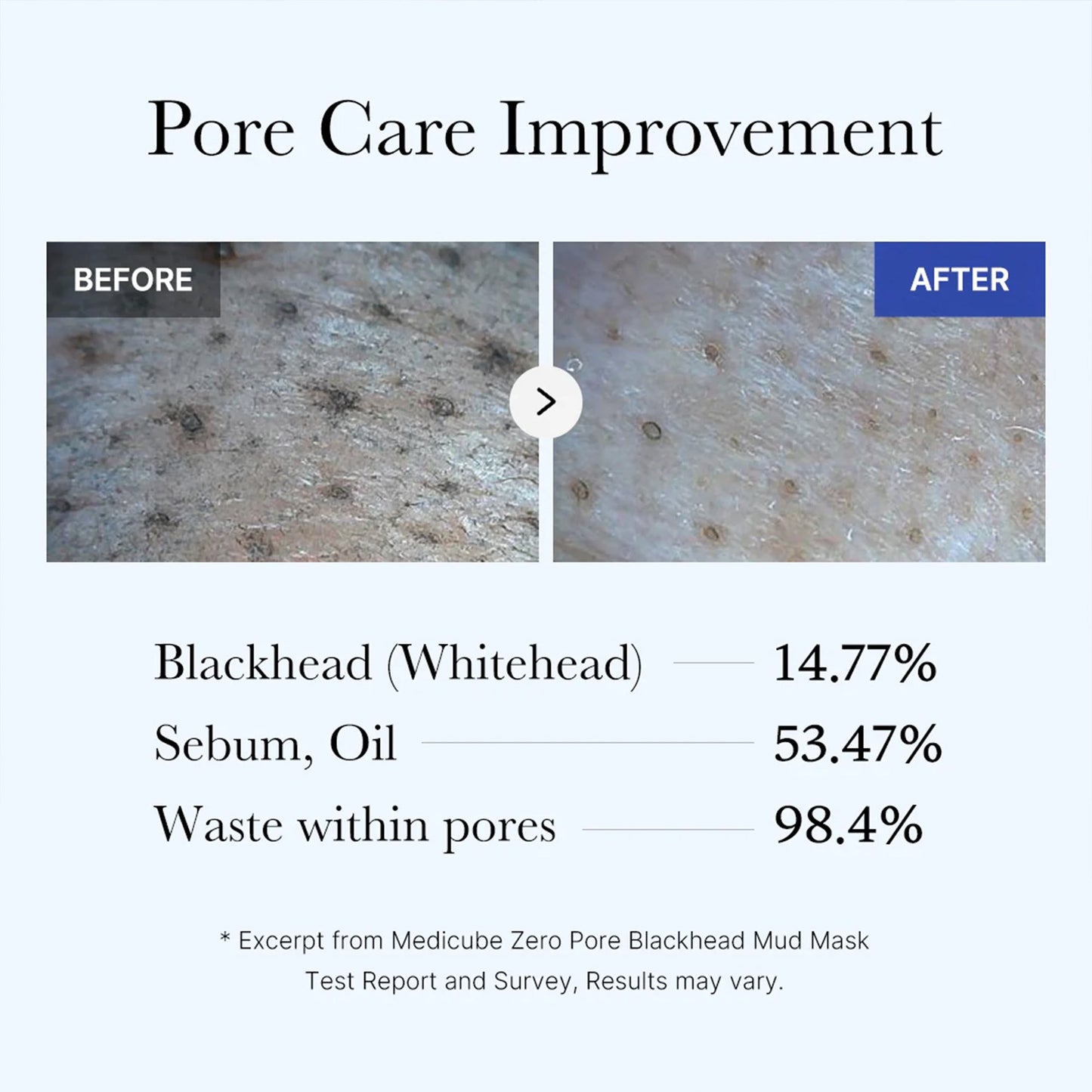 zero-pore-blackhead-mud-mask-e5 05_9362a158-c2b3-4525-acc0-631a2cfdea47.jpg