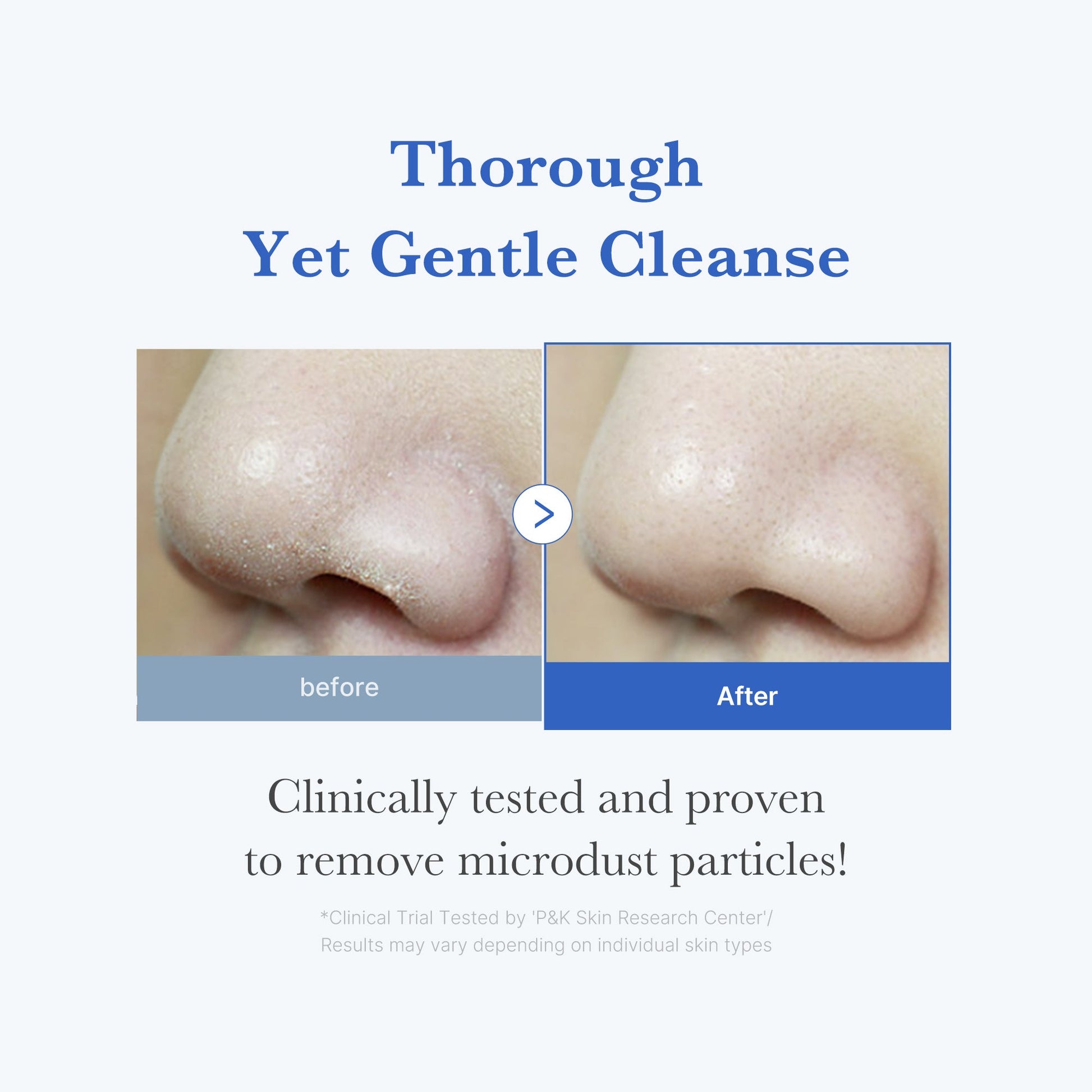 zero-foam-cleanser-u7 250702_ZeroCleanser3.jpg