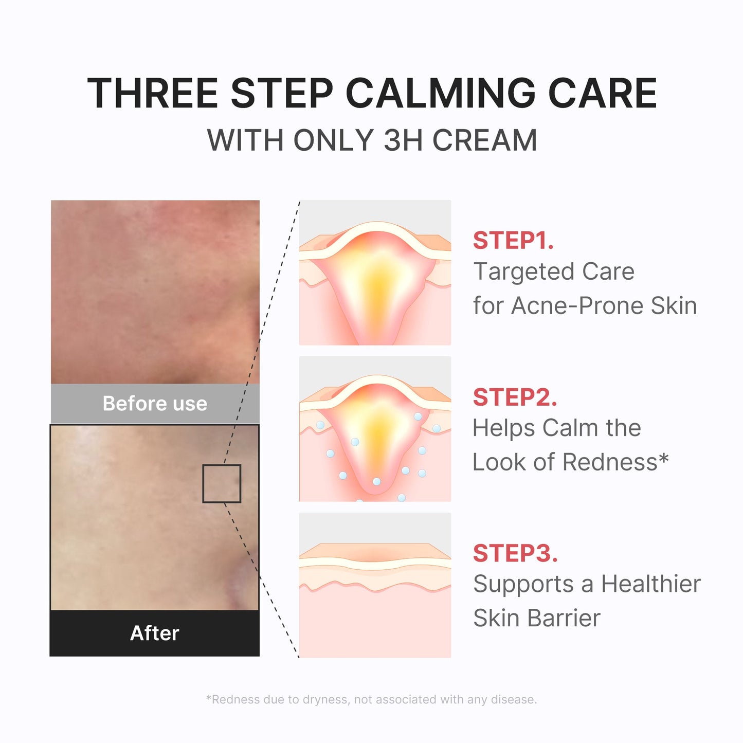 3h-daily-relief-cream-e7 3H_04.jpg