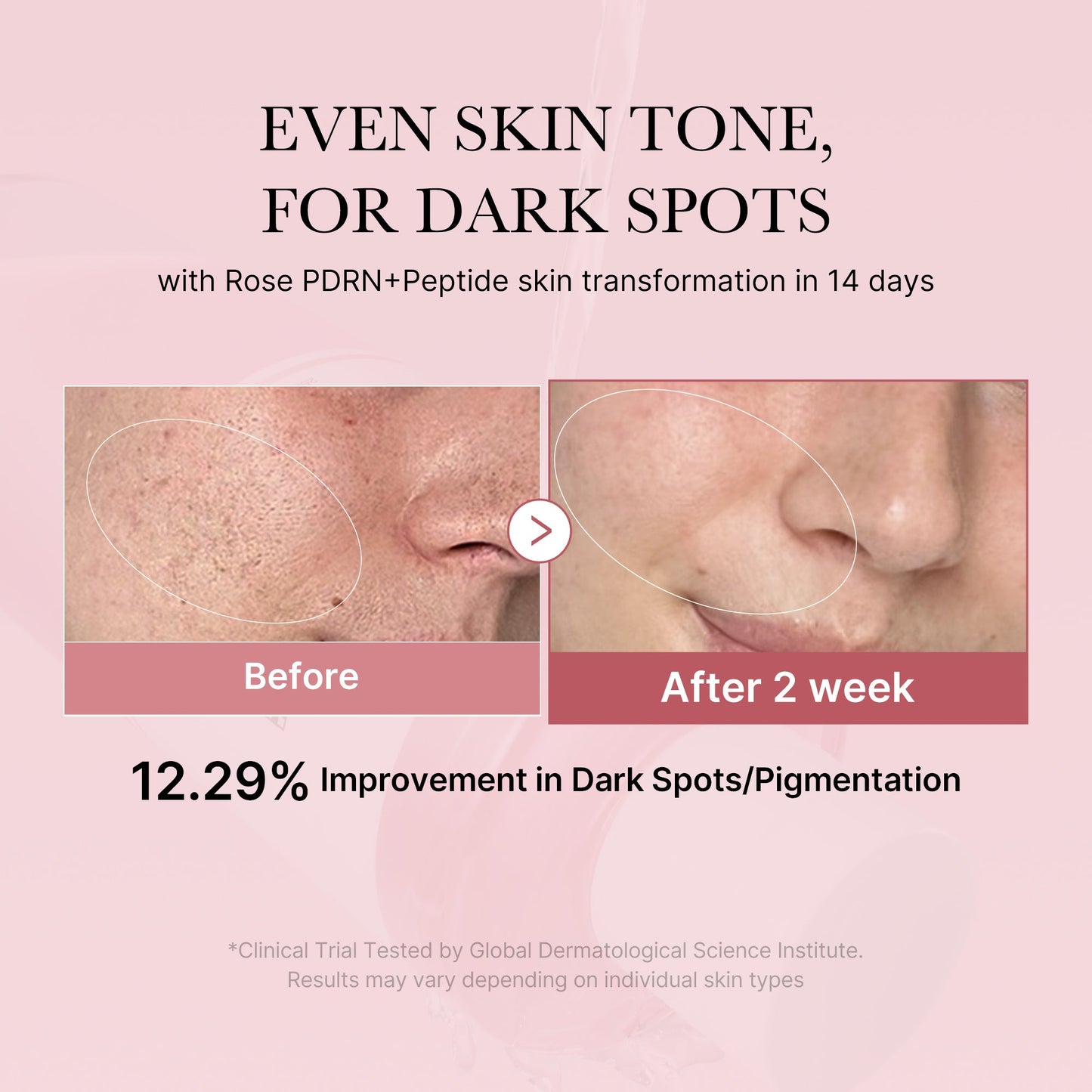 pdrn-pink-peptide-toner-x6 PDRN_01_308c518e-5ac6-4e54-99bd-eabc8796739b.jpg