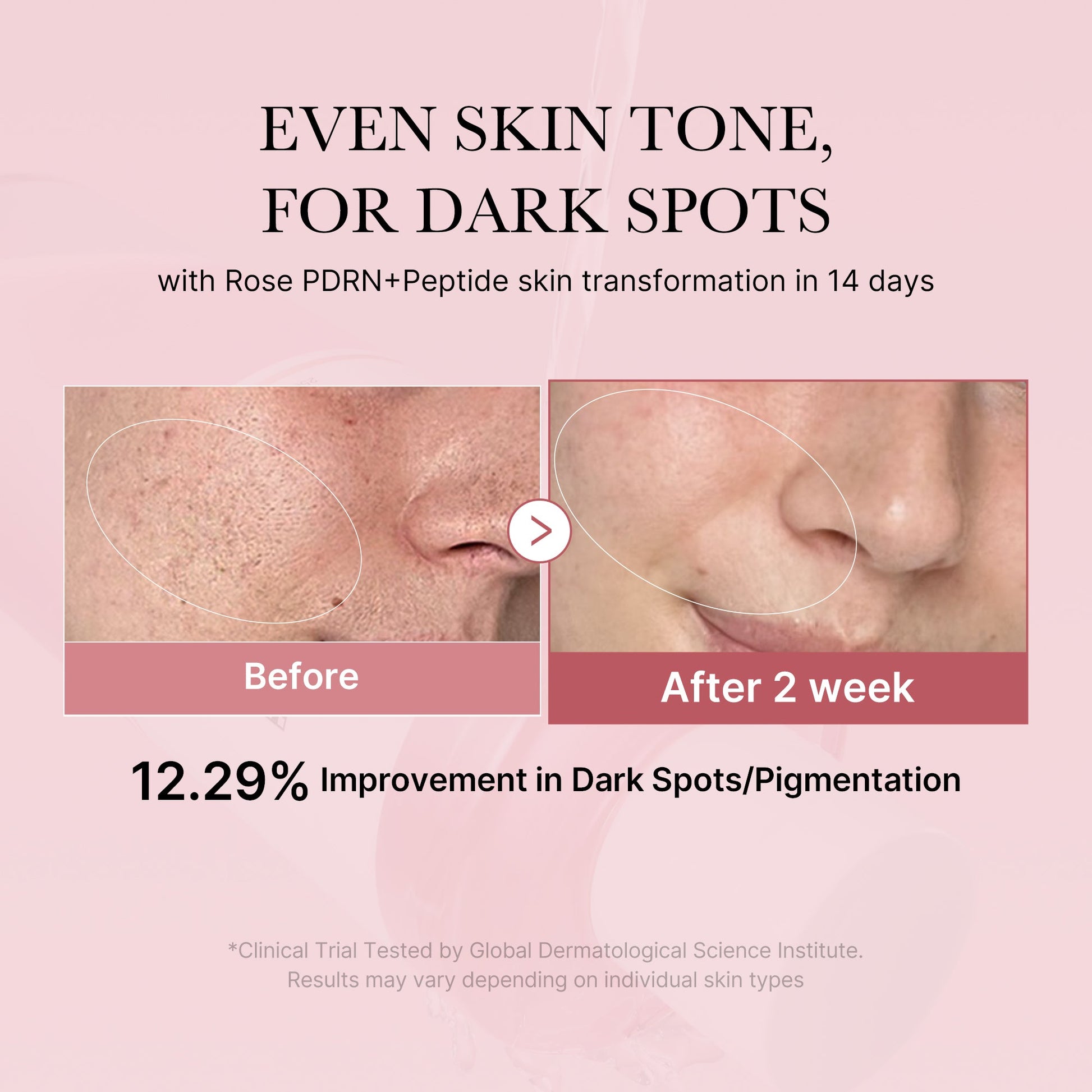pdrn-pink-peptide-toner-x6 PDRN_01_308c518e-5ac6-4e54-99bd-eabc8796739b.jpg