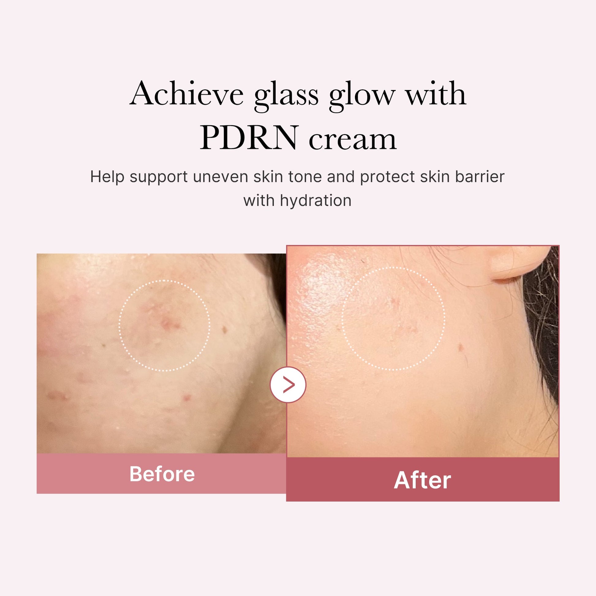 pdrn-pink-peptide-cream-k4 PDRN_02_d7805bfe-cf43-446a-b71b-a276683f136b.jpg