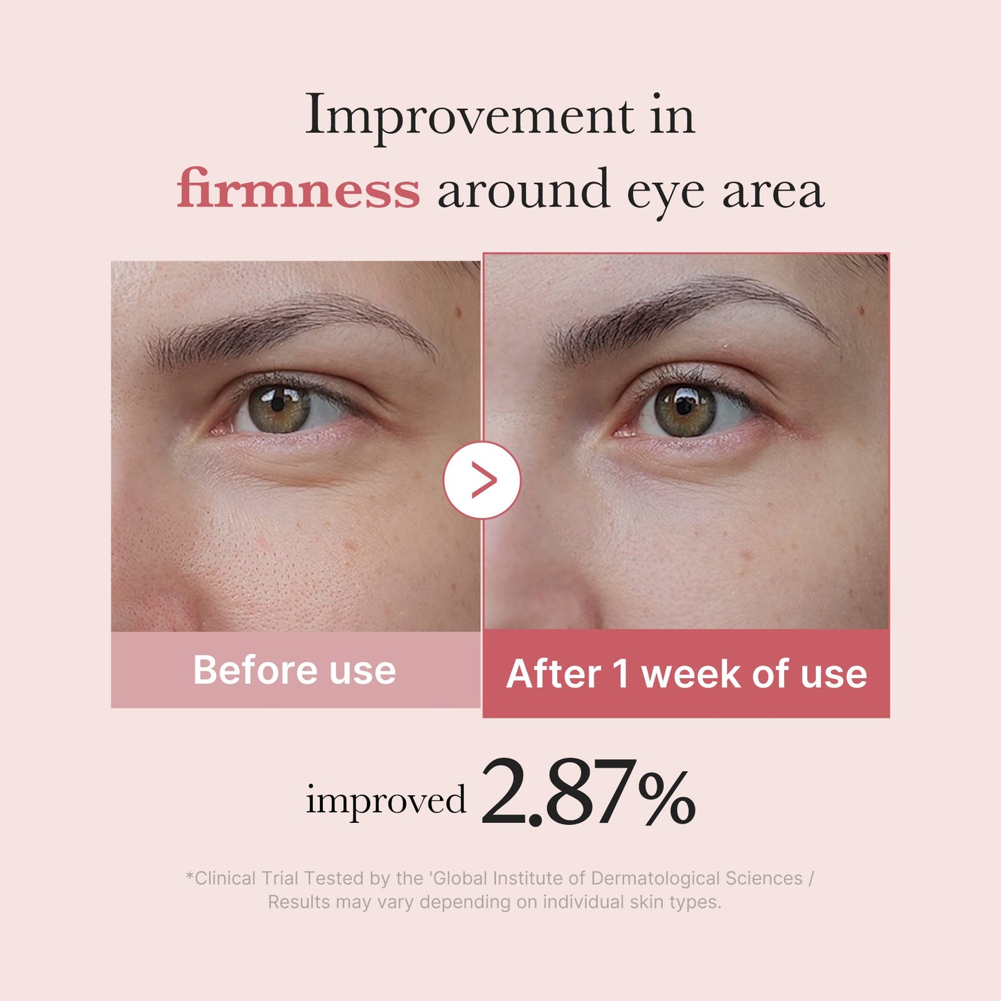 pdrn-pink-peptide-eye-cream-w8 PDRN_03_256dd753-0a2f-41b4-b3cd-bbfd3bc27018.jpg