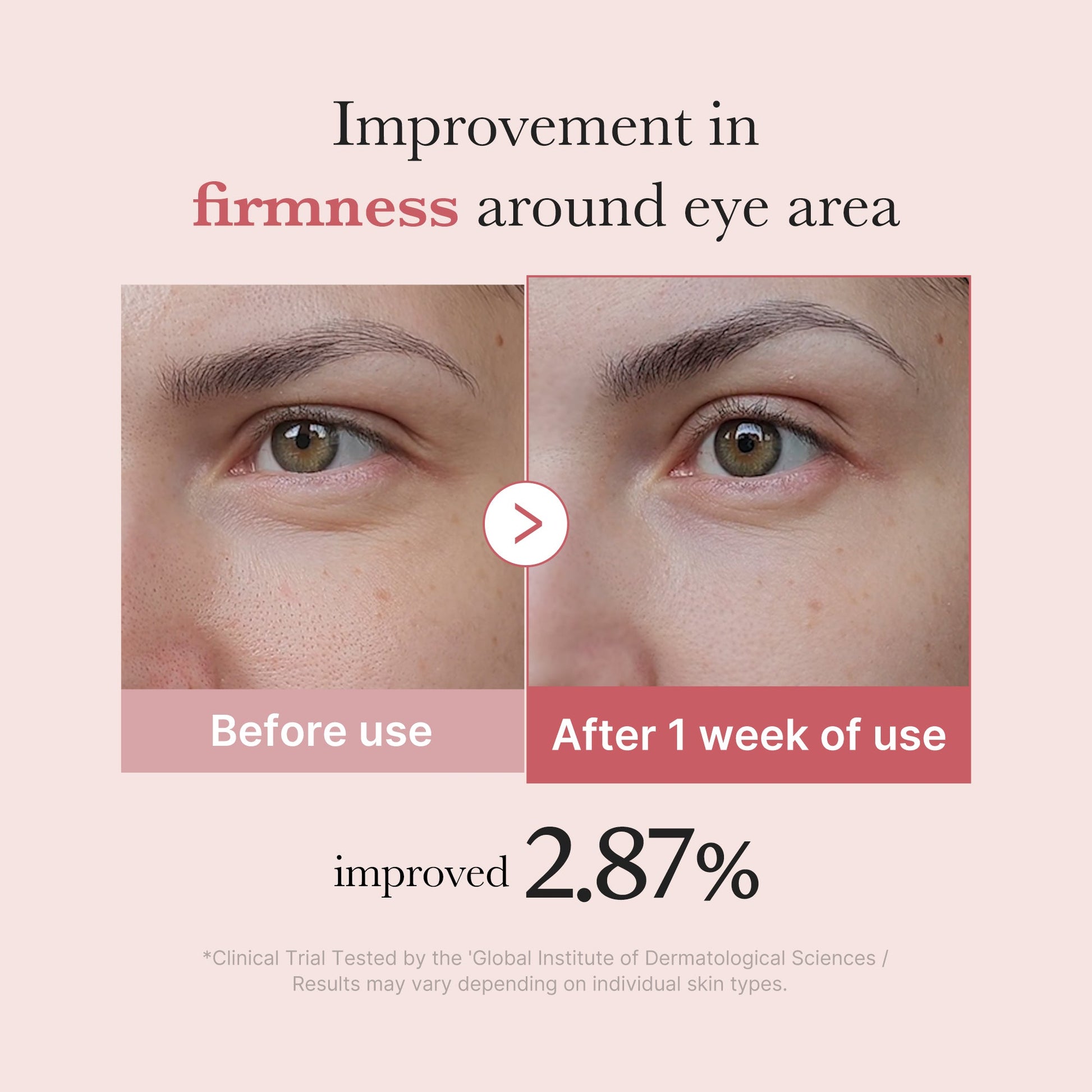 pdrn-pink-peptide-eye-cream-w8 PDRN_03_256dd753-0a2f-41b4-b3cd-bbfd3bc27018.jpg