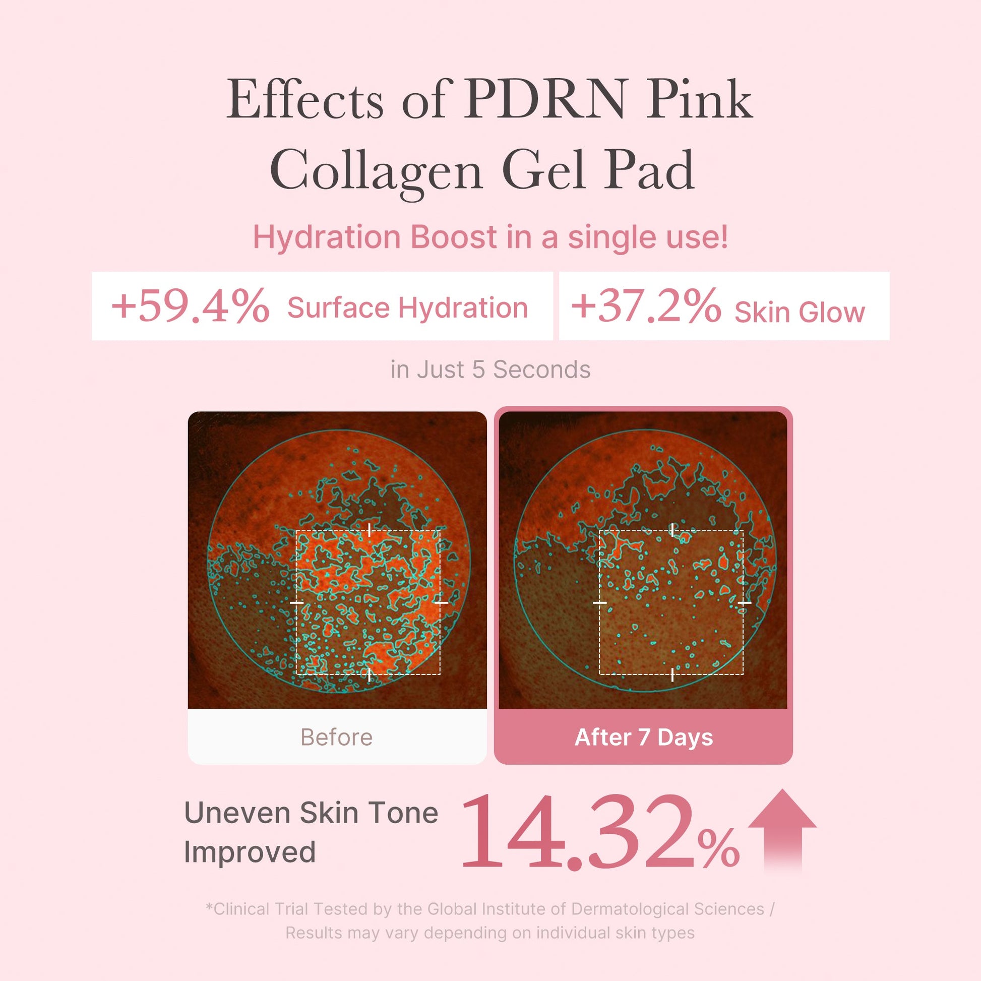 pdrn-pink-collagen-gel-toner-pad-y4 PDRN_04_f9a16a56-8d9e-4c47-a635-ed34ec3ed571.jpg