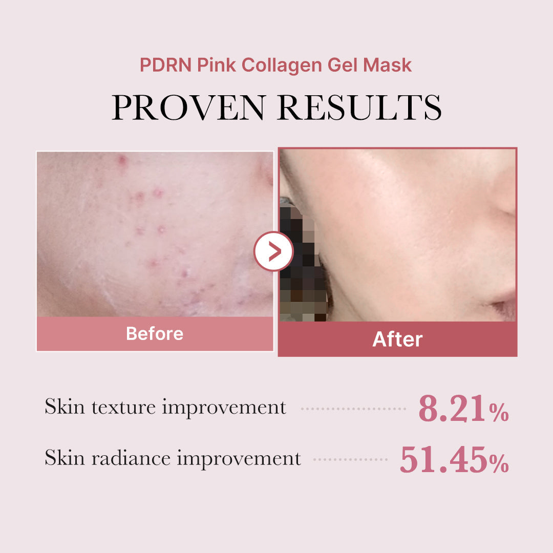 salmon-pdrn-pink-collagen-jelly-gel-mask-z9 PDRN_12.jpg