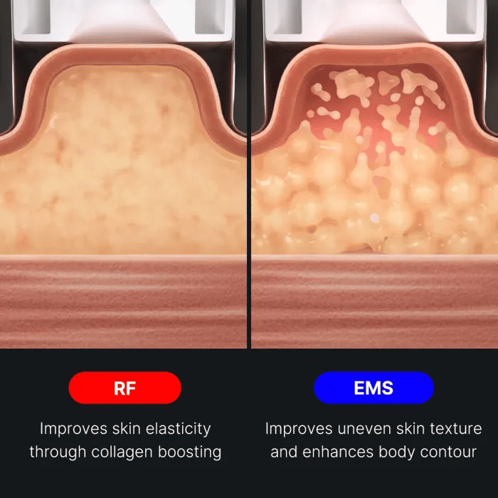 age-r-contour-body-shot-l3 img.webp
